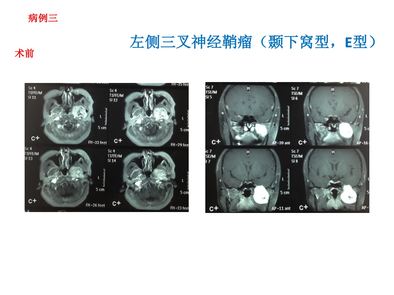 无效图片