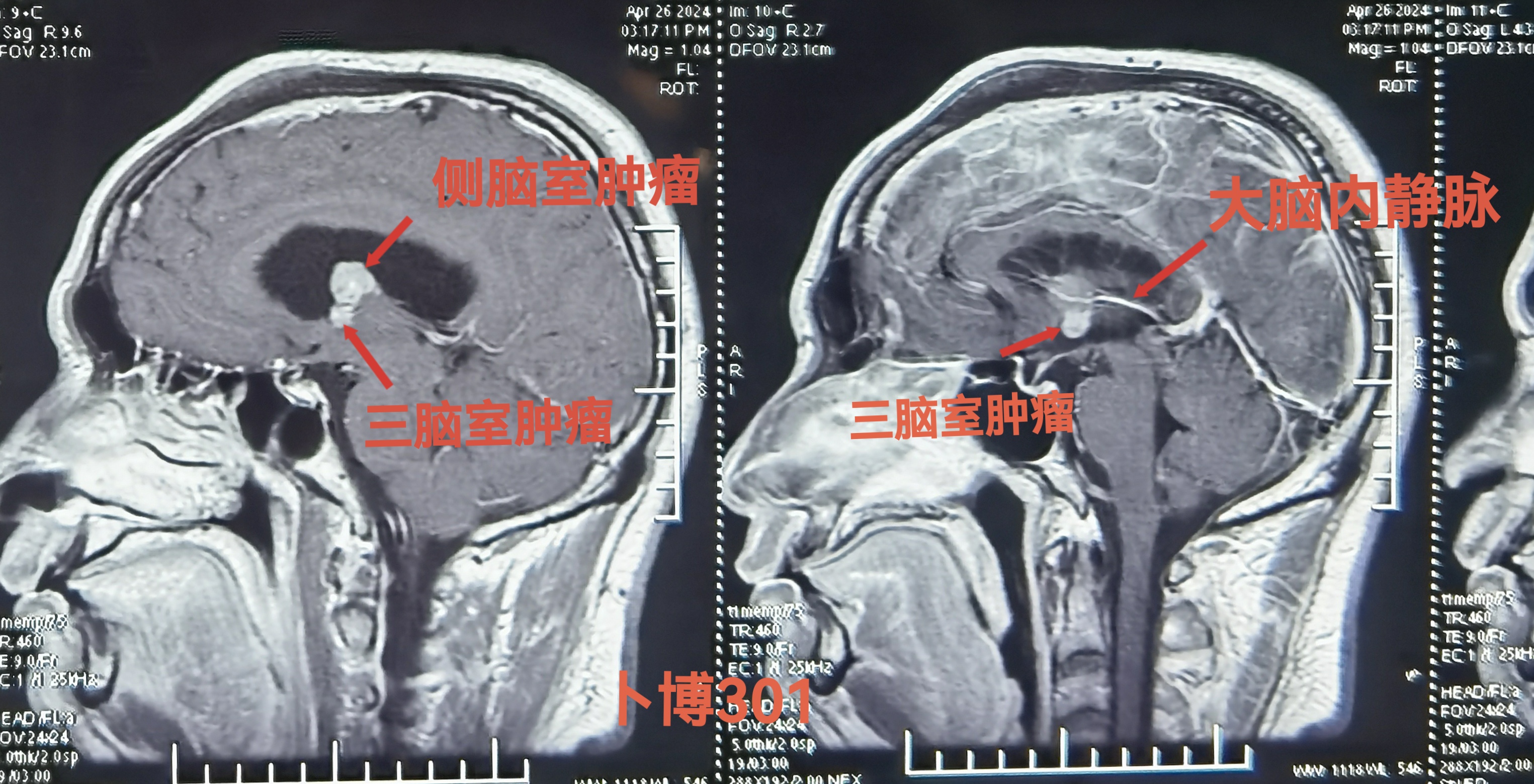 无效图片