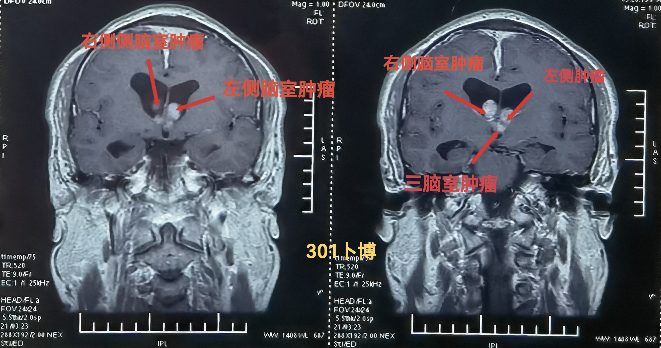 无效图片