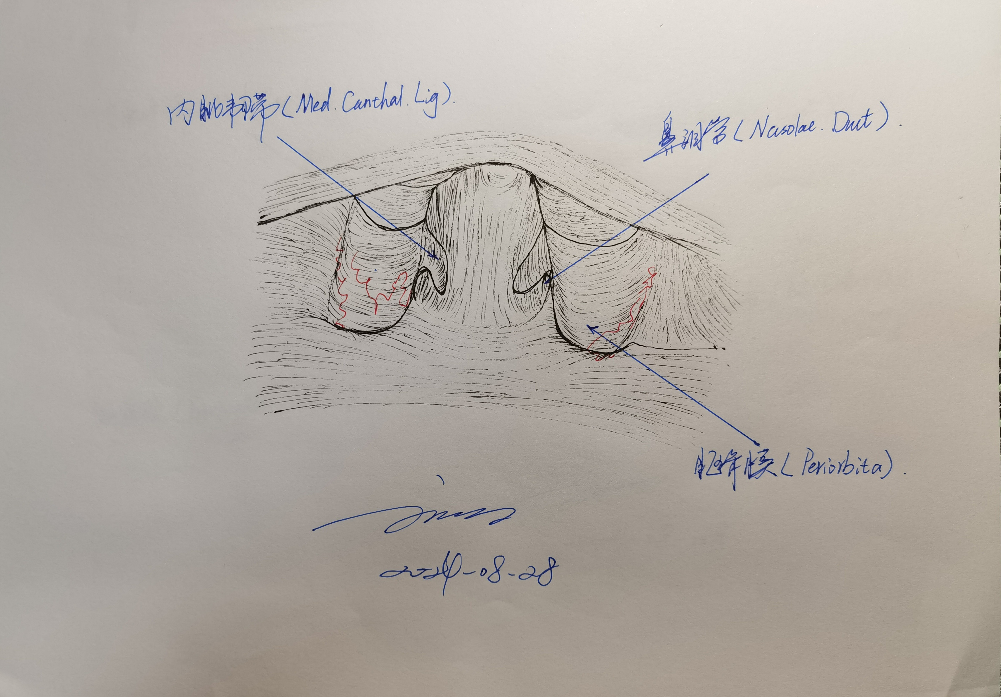 Transbasal Approach 学习RHOTON解剖学手绘—经颅底(transbasal)和扩大经额入路的关系(一) - 脑医汇