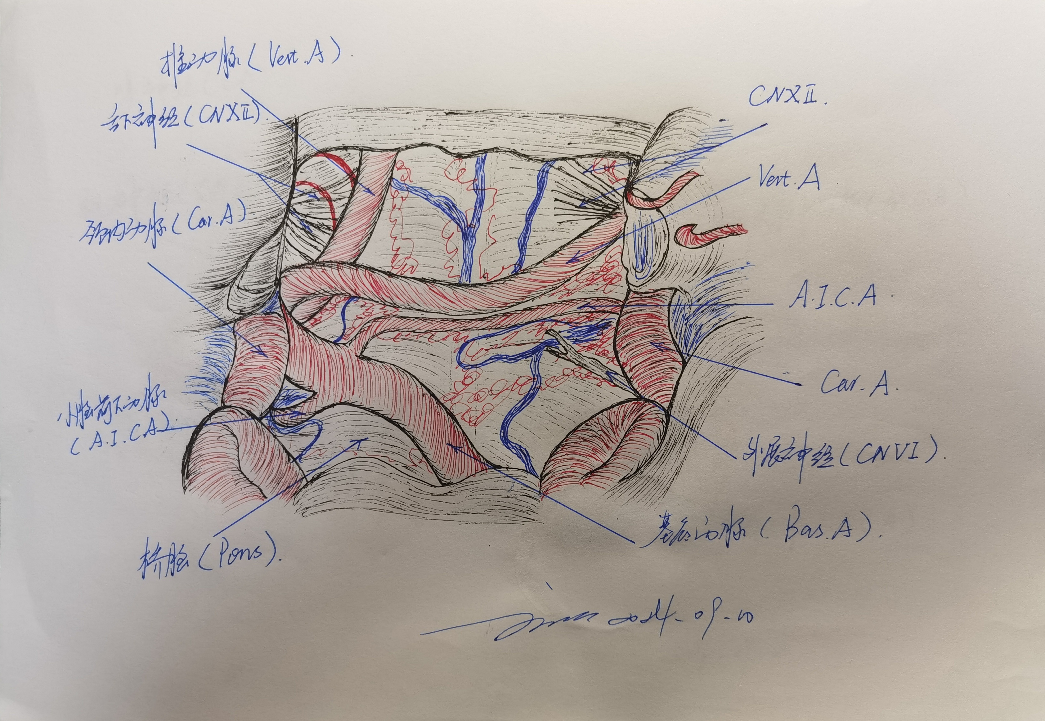 Transbasal Approach 学习RHOTON解剖学手绘—经颅底(transbasal)和扩大经额入路的关系(三) - 脑医汇 - 神外资讯 - 神介资讯