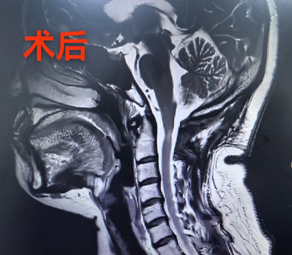 无效图片