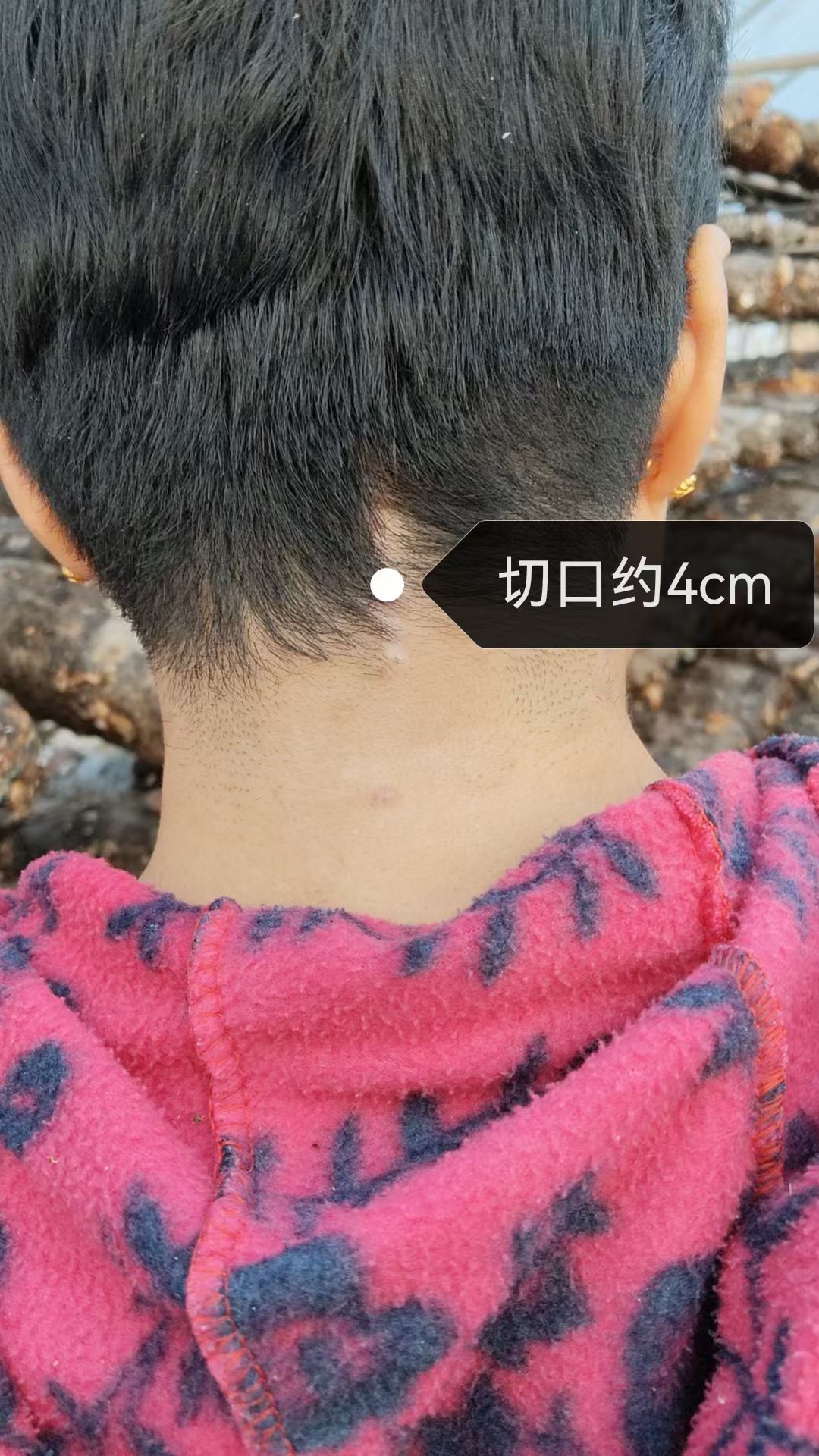 无效图片