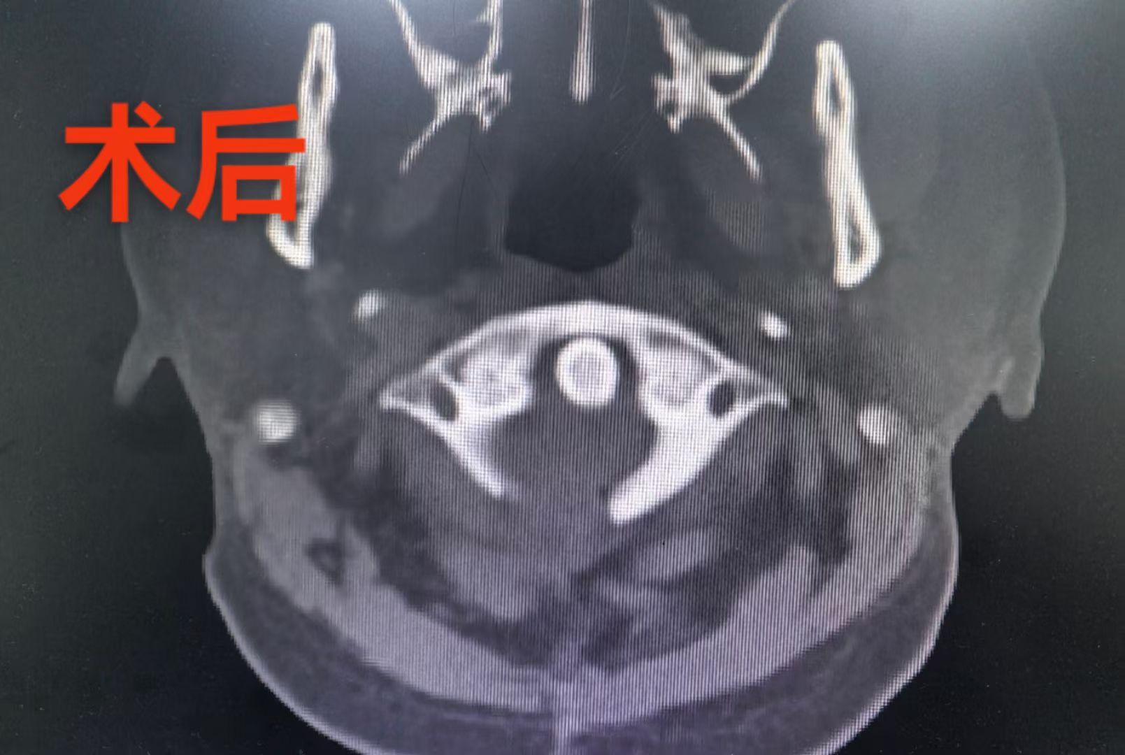无效图片