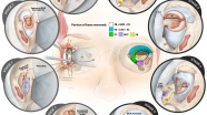内镜经眶入路手术（Endoscopic Transorbital Surgery）的分级系统