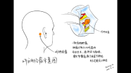 听神经瘤临床症状解读
