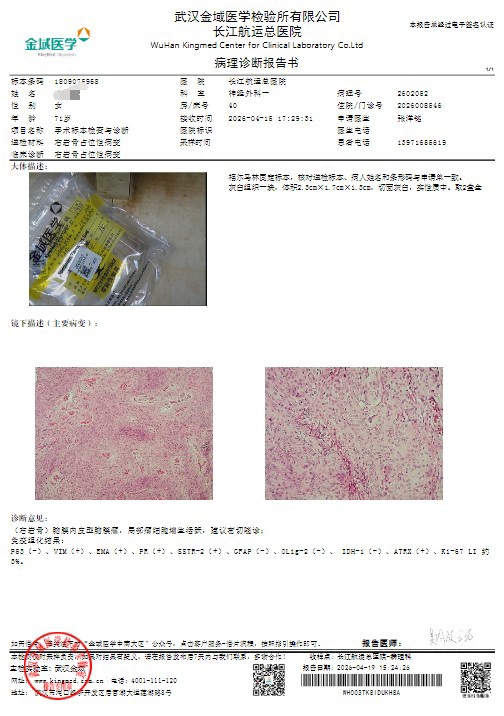 无效图片