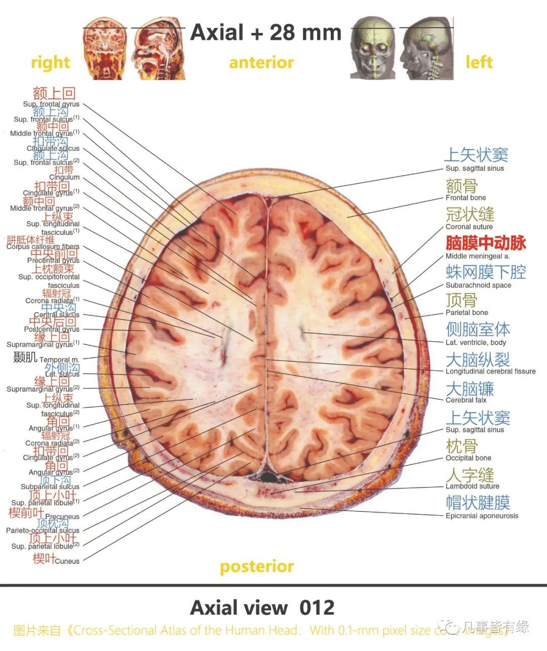 anatomy四,颅脑mri断层解剖结构标注section anatomy五,脑干轴位断层