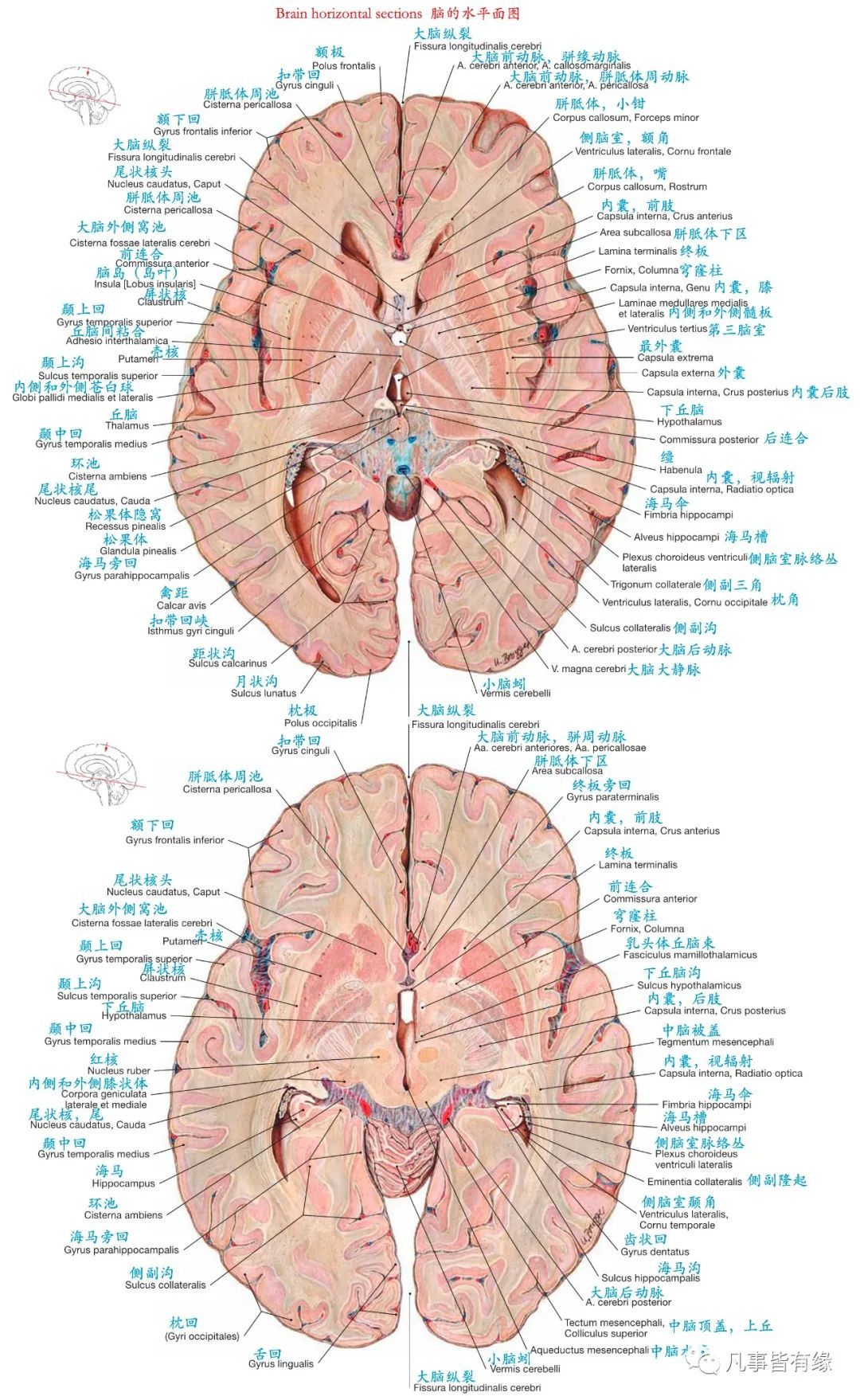 anatomy四,颅脑mri断层解剖结构标注section anatomy五,脑干轴位断层