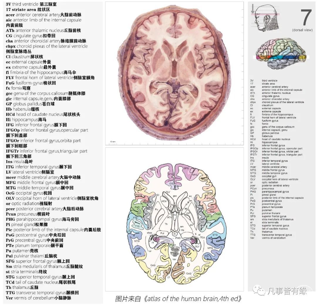 四,顱腦mri斷層解剖結構標註section anatomy五,腦幹軸位斷層解剖示意