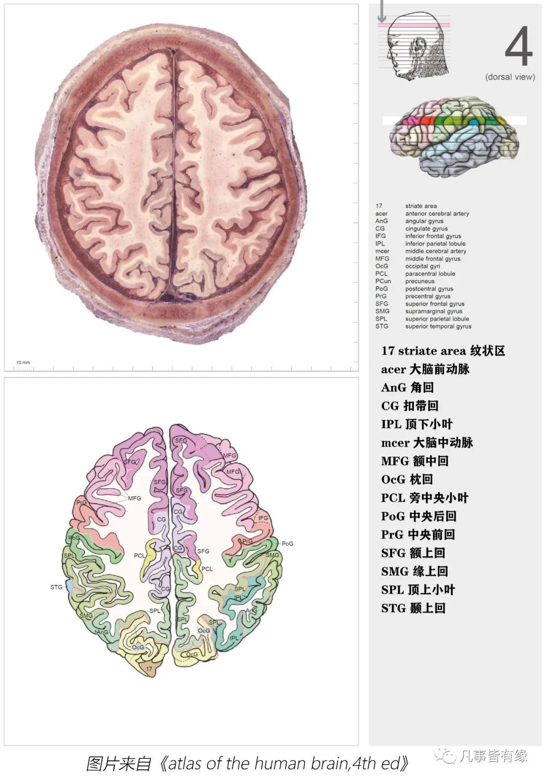 顱腦斷層解剖軸位