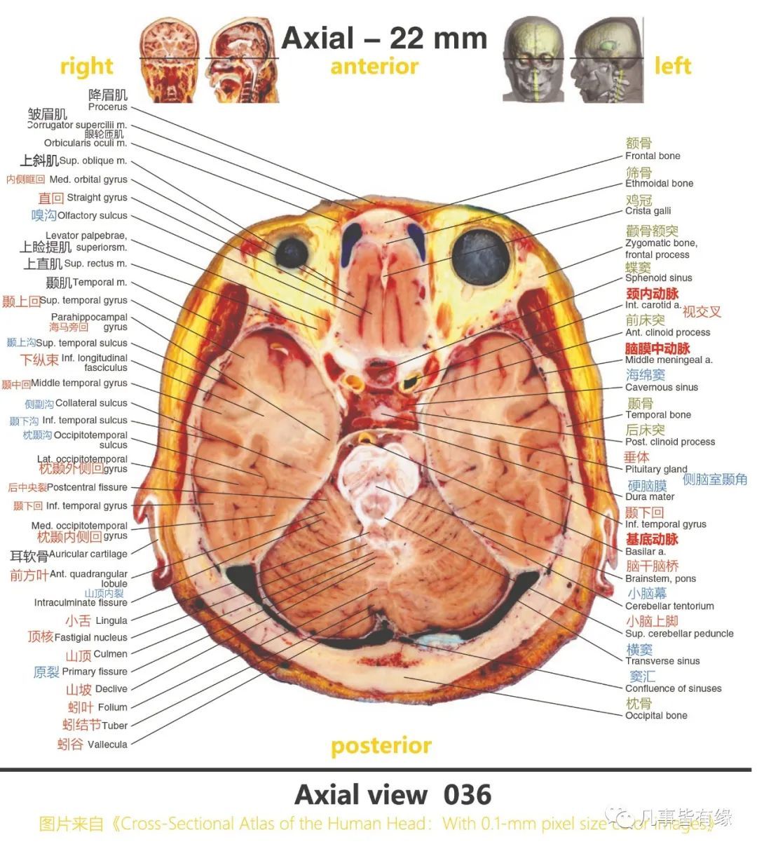 顱腦mri斷層解剖結構標註section anatomy五,腦幹軸位斷層解剖示意圖