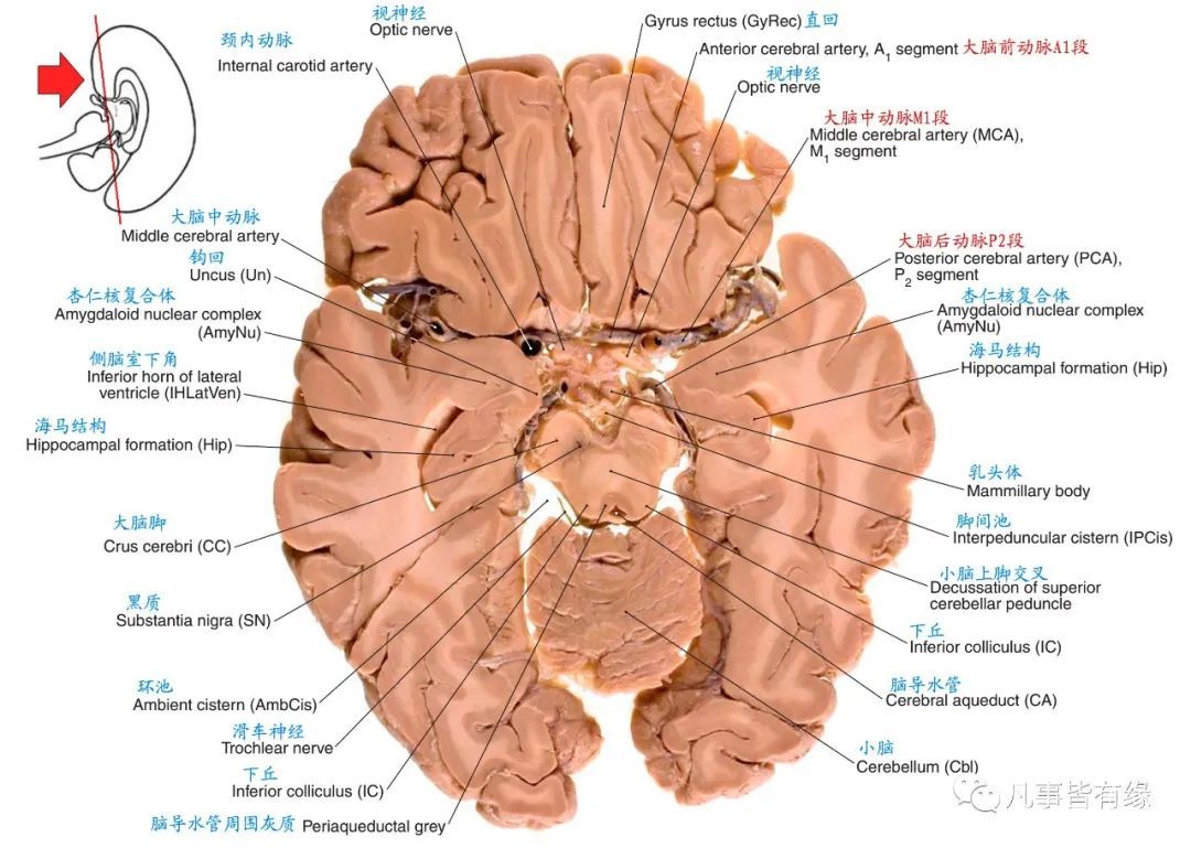 anatomy四,颅脑mri断层解剖结构标注section anatomy五,脑干轴位断层