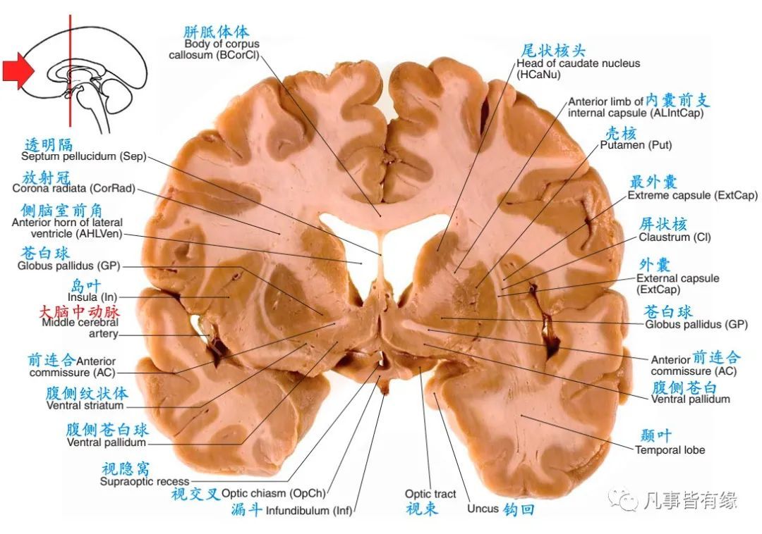 冠状断层线条图section anatomy四,颅脑mri冠状断层解剖结构标注