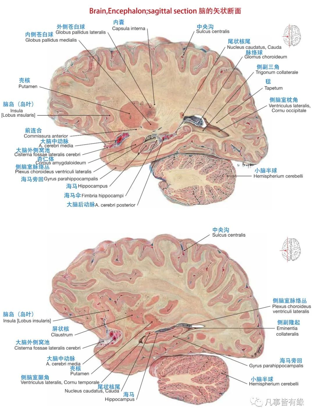 大脑矢状窦解剖图图片