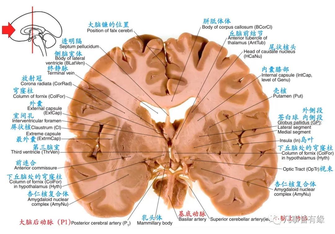 冠状断层线条图section anatomy四,颅脑mri冠状断层解剖结构标注