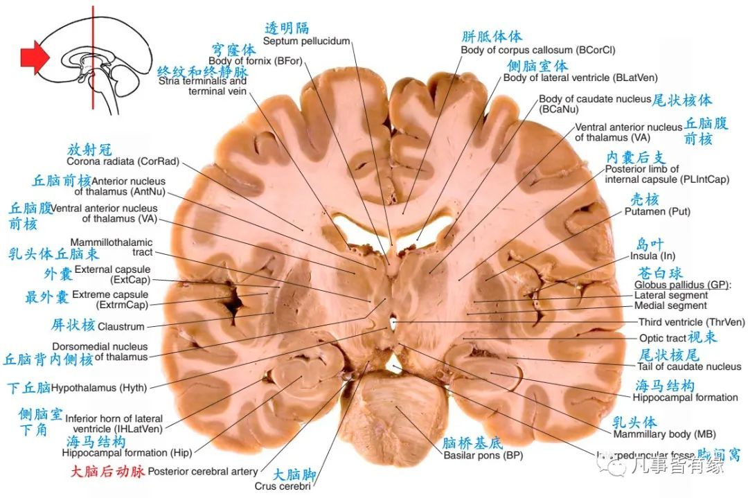 冠状断层线条图section anatomy四,颅脑mri冠状断层解剖结构标注