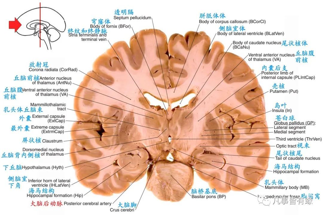 大脑冠状平面图图片