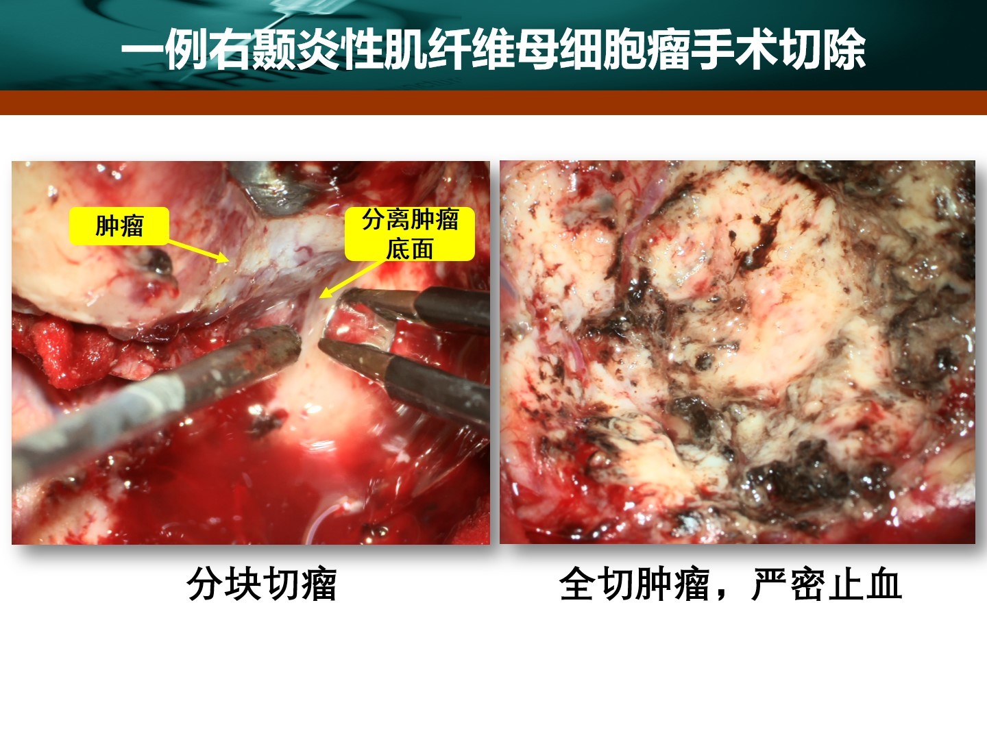 幻灯片6.jpg