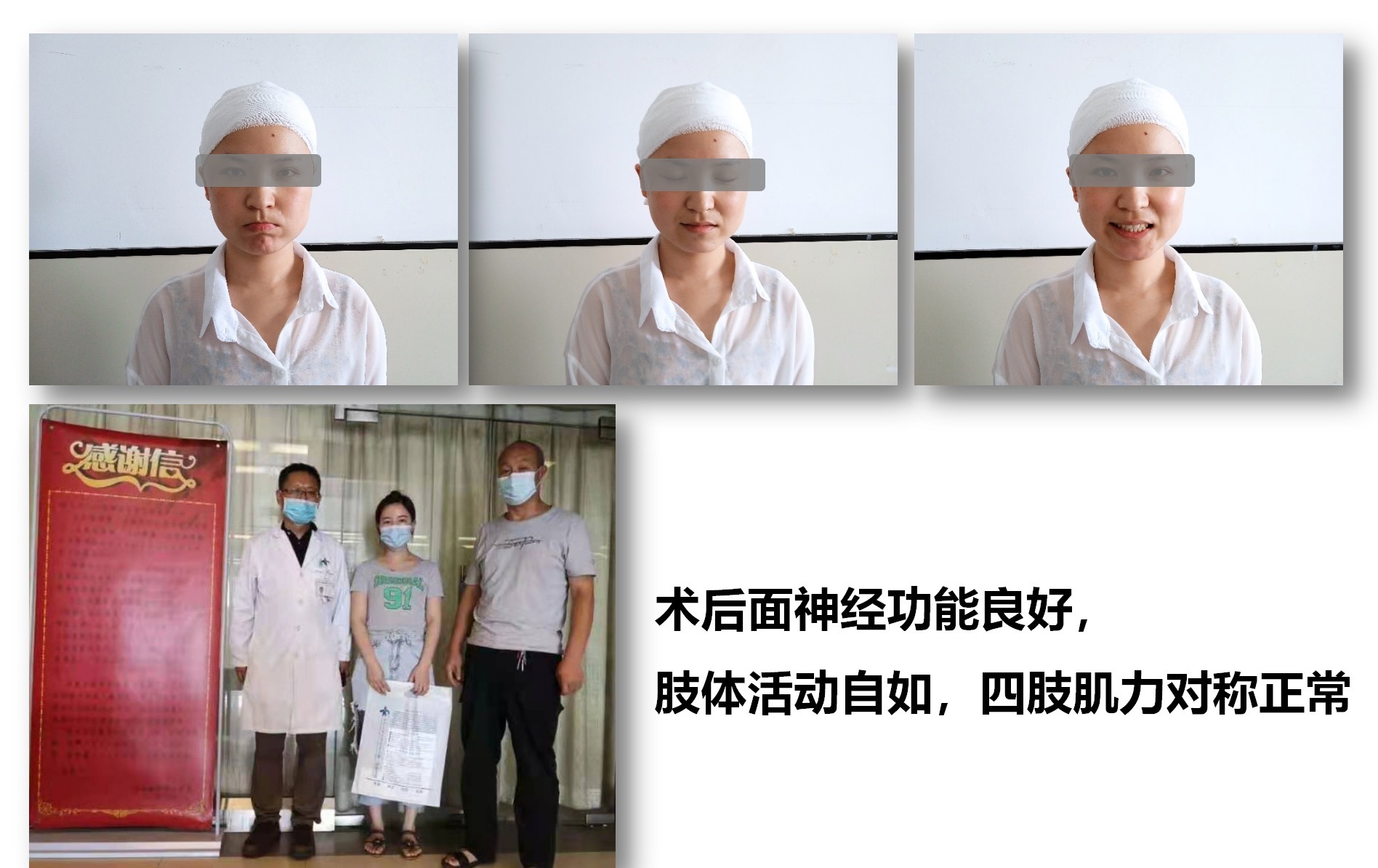一例脑干海绵状血管瘤切除术_11.png