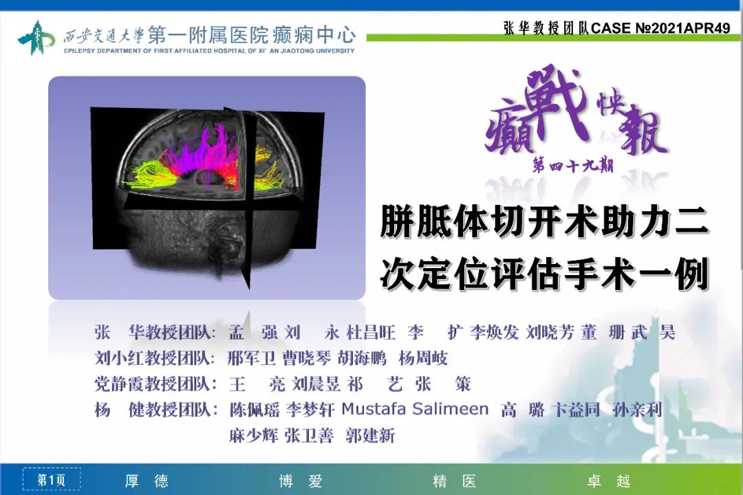【癫战快报】第49期：胼胝体切开术助力二次定位评估手术一例