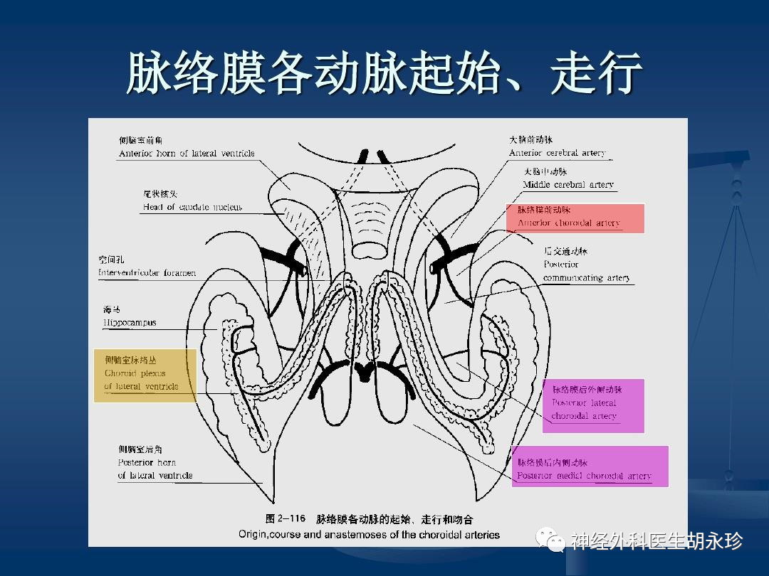 脑动脉瘤夹闭术后脑梗死脉络膜前动脉梗死