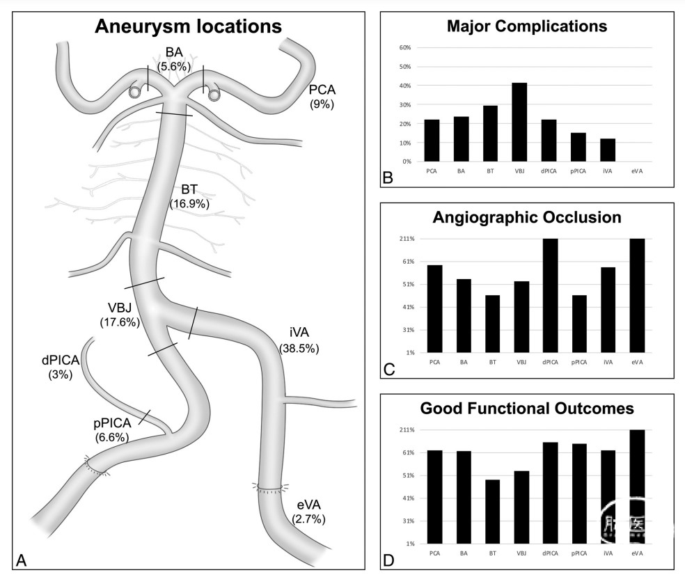 后循环动脉瘤的血流导向治疗不同个体数据的分解系统回顾