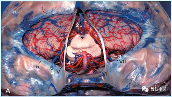 收藏腦血管解剖知識學習筆記腦靜脈