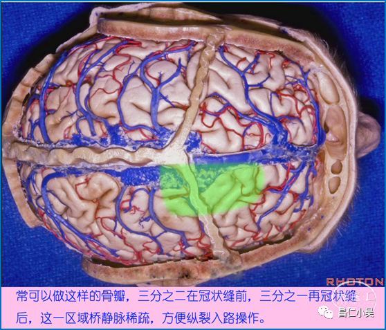 收藏腦血管解剖知識學習筆記腦靜脈