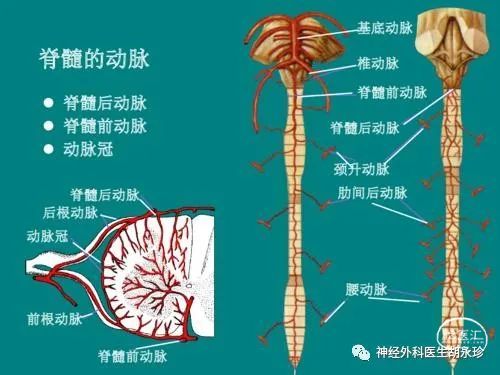 硬脊膜动静脉瘘