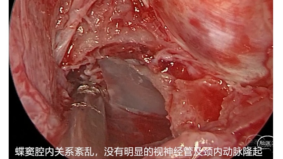 f8a293f84eca4321ae914ede556b5007.jpg