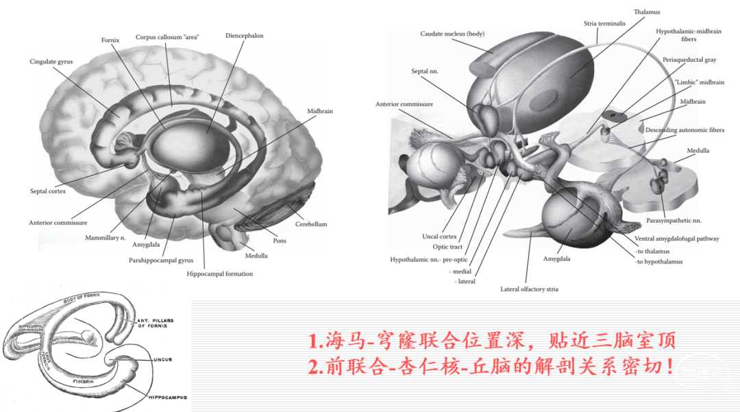 術的相關解剖環島葉功能性大腦半球切開術環島葉大腦半球切開術基底節