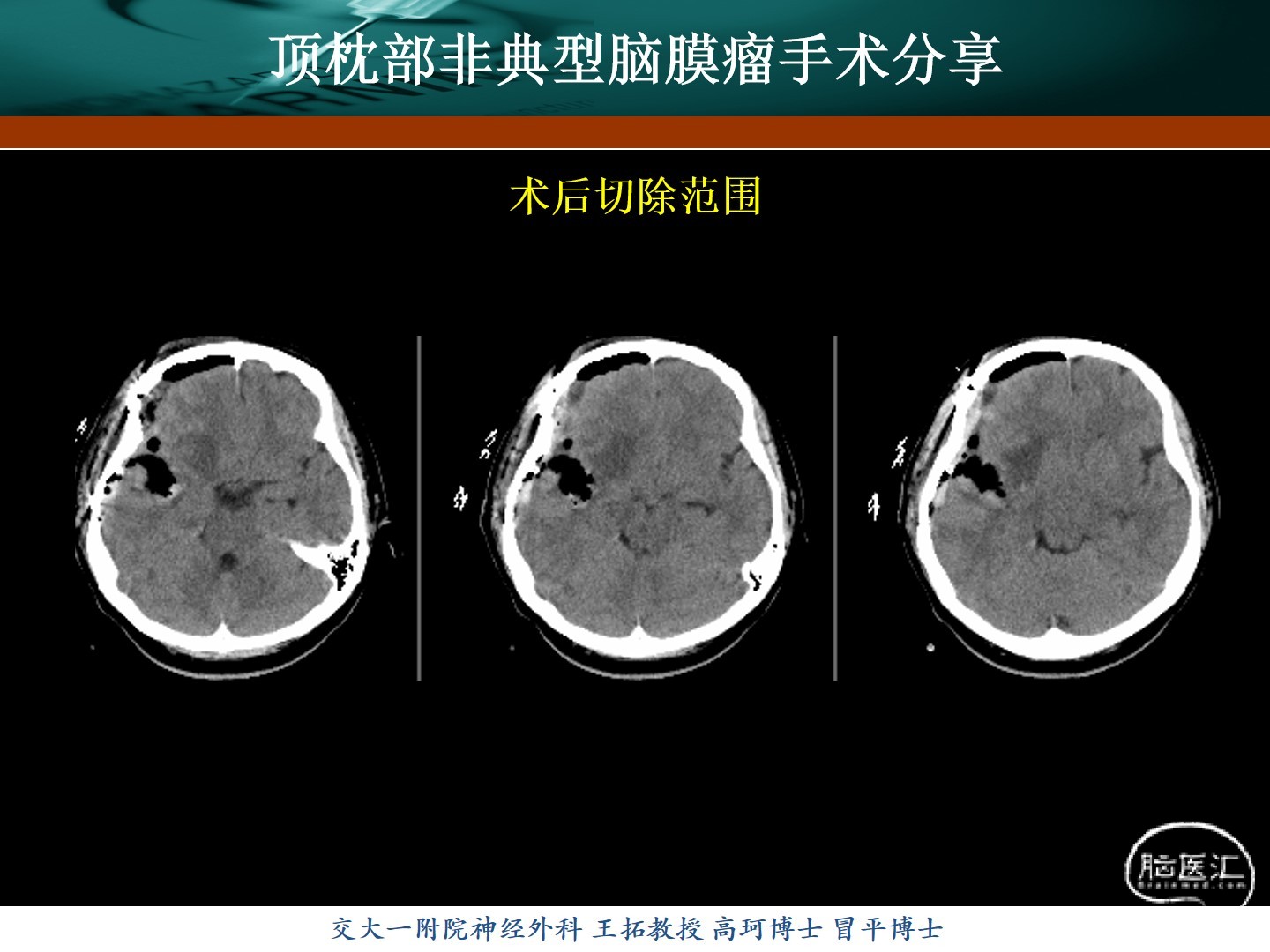 幻灯片9.jpg