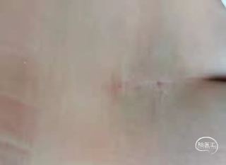resize,m_lfit,w_120
