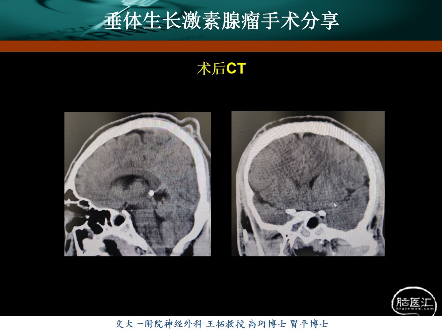 幻灯片9.jpg