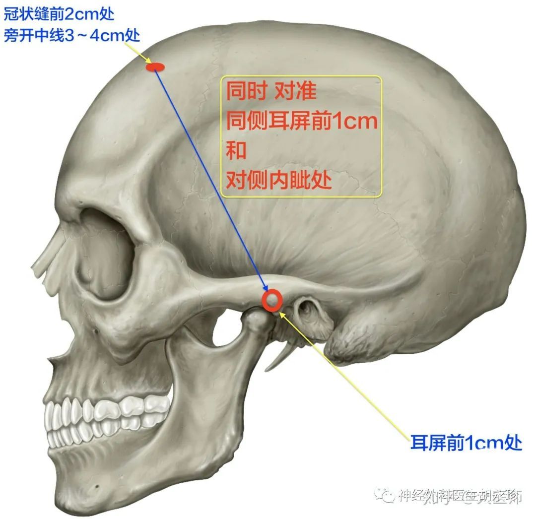 关于高角低角，看这一篇就够了----头影测量 - 知乎