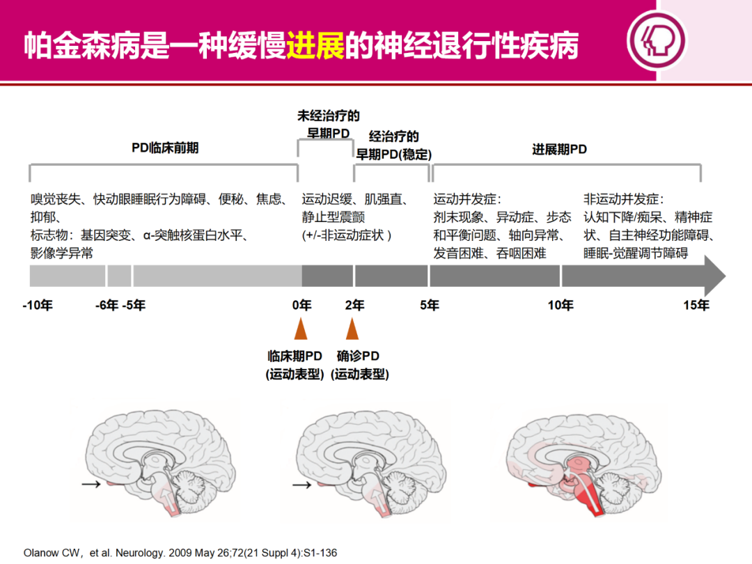 帕金森发病率图片