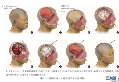 1641277755459508.jpg 10.jpg