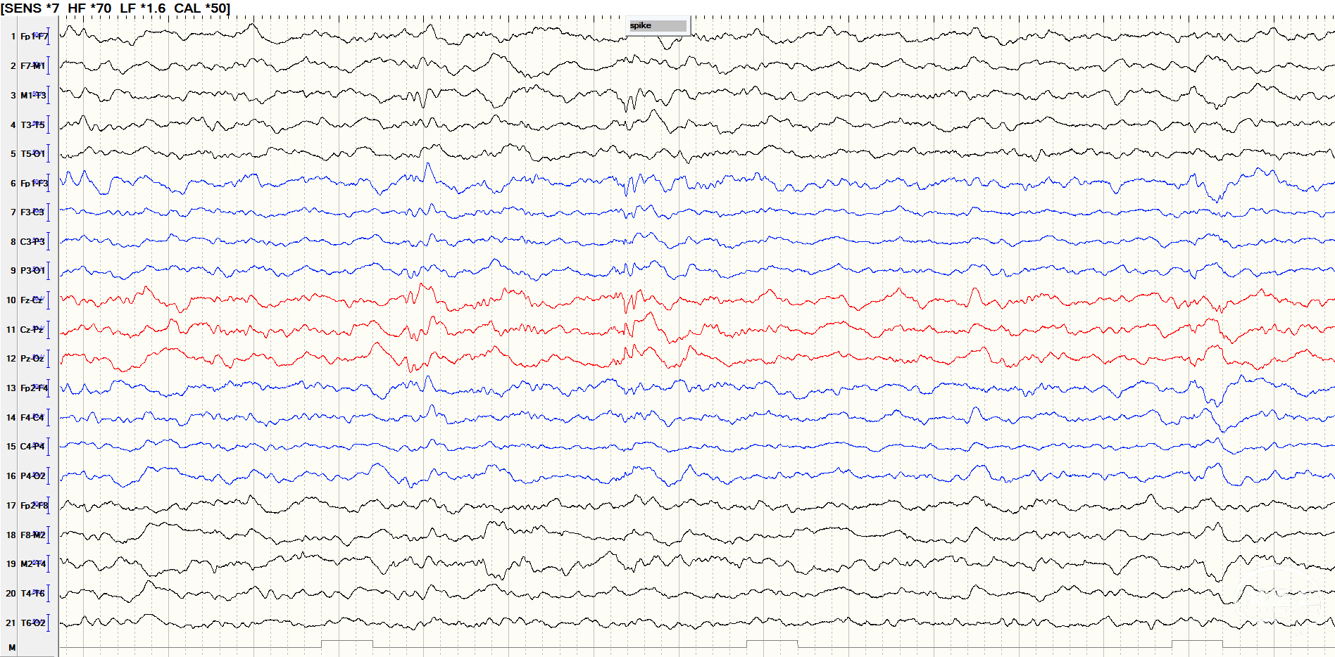 3bda709e45efbf62fa136310a71665aa.png