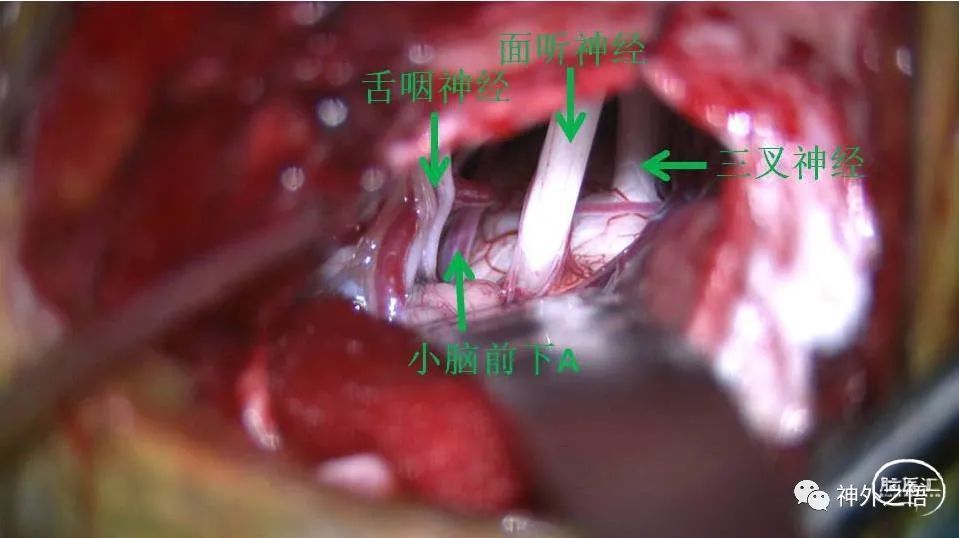 d1b12e25b620fd47a083d3edce260194.jpeg