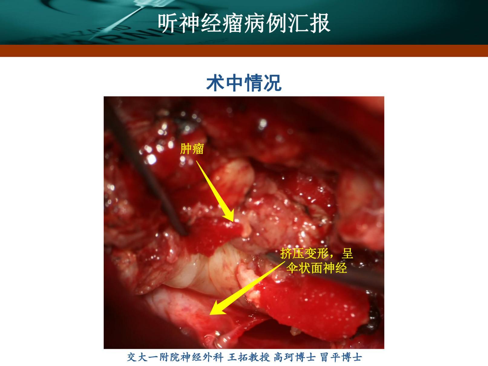 刘振听神经瘤_20220117121053_纯图版_09.jpg