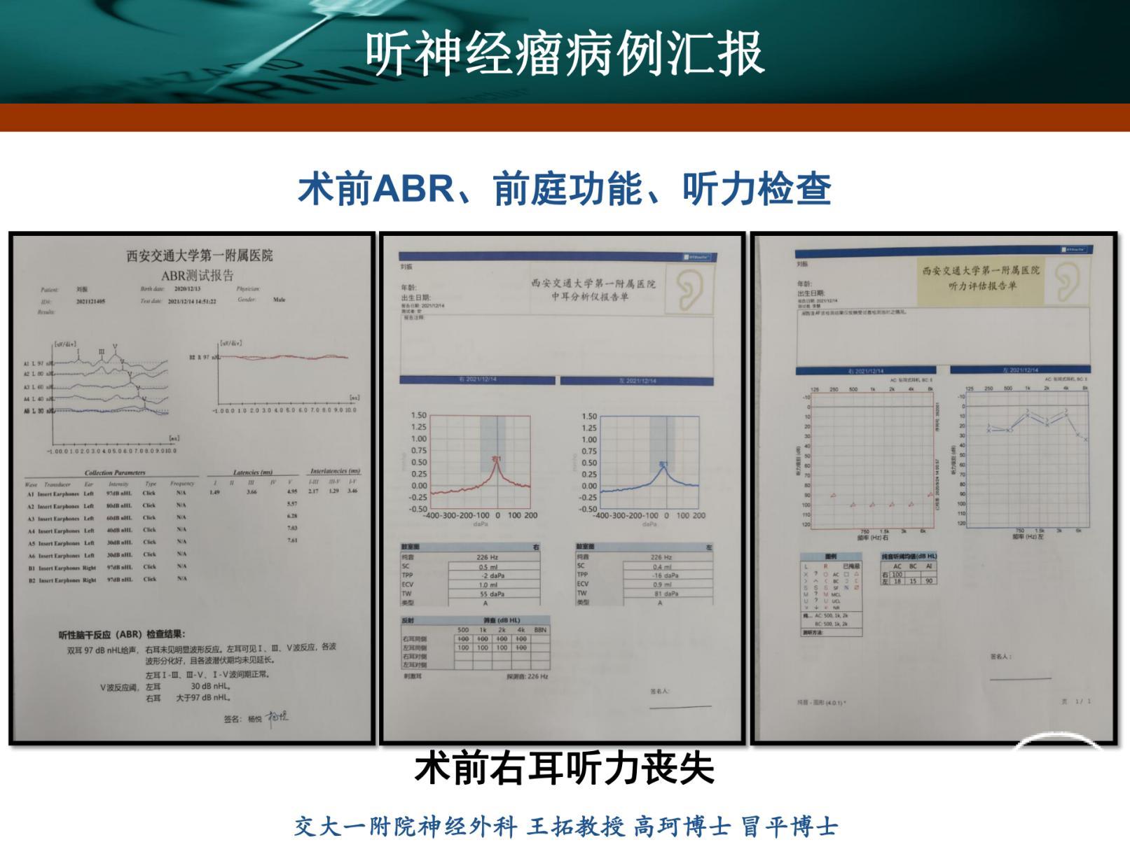 刘振听神经瘤_20220117121053_纯图版_03.jpg