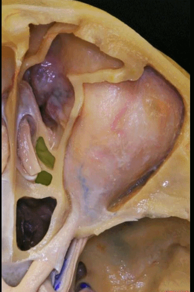 sphenoid bone图片