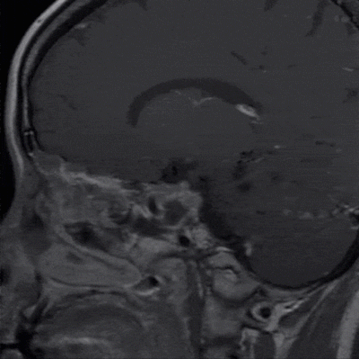 13case2.gif
