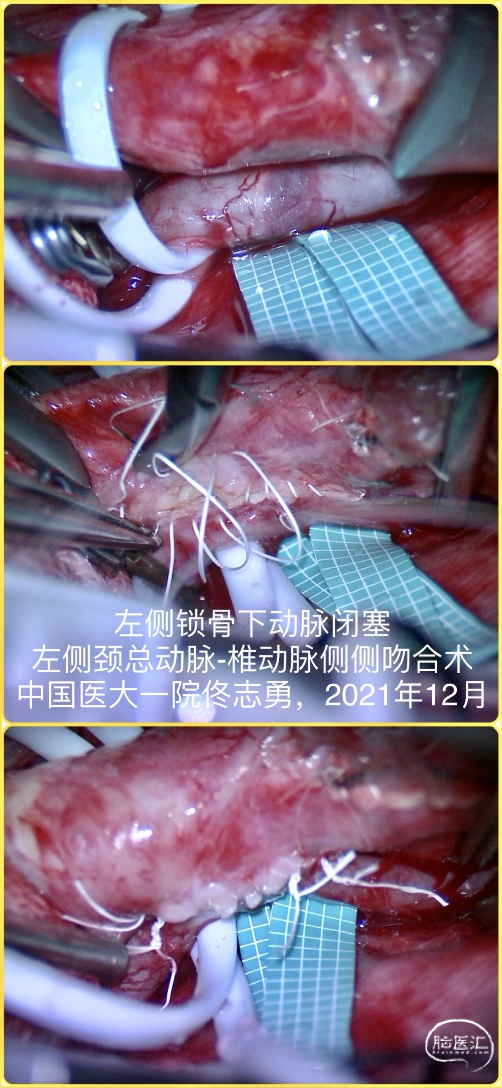 c5318b0fd8144c65a9469c76268874be_uhd.jpg