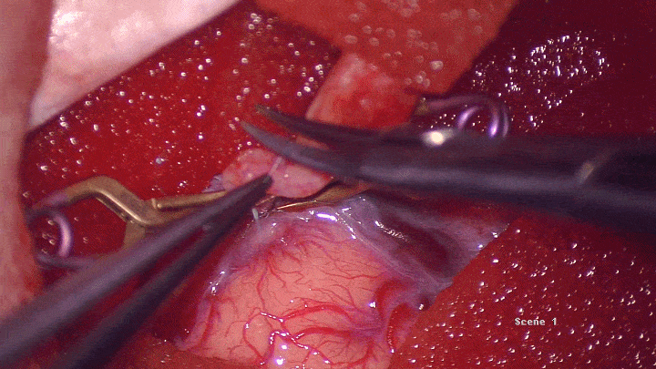 8f3a02648f8dbc124976a1a1aeedd158_640_wx_fmt=gif&wxfrom=5&wx_lazy=1.gif