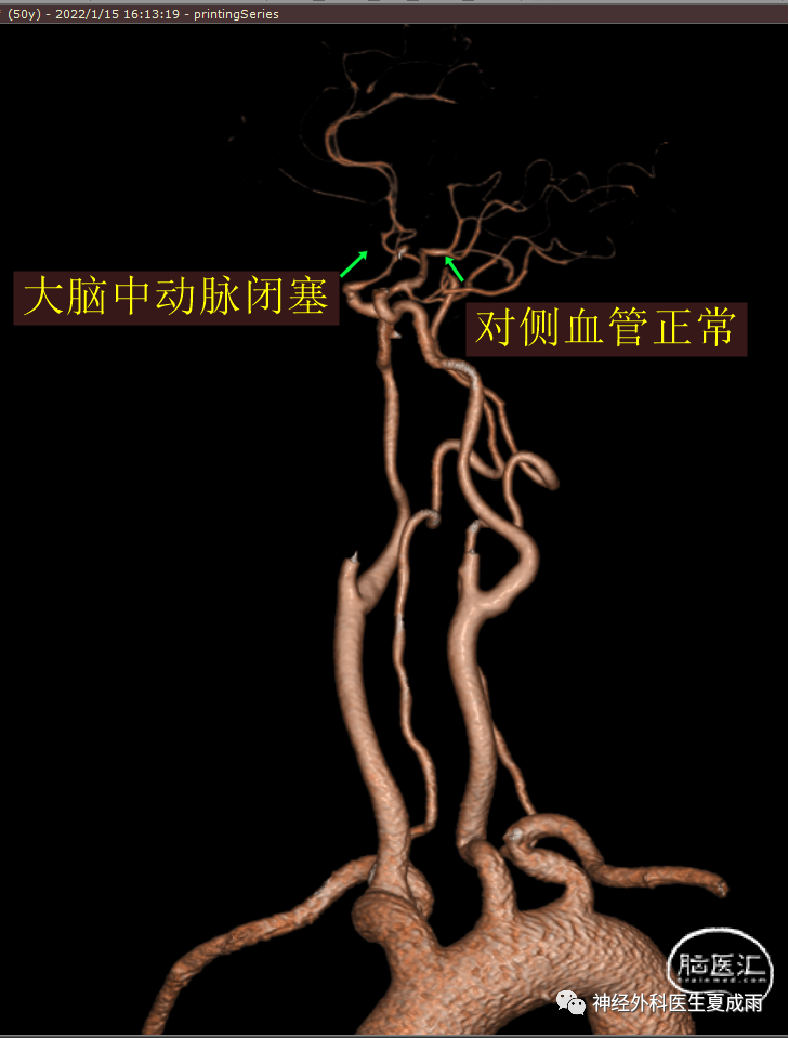 bd2cacba533e51c788d74714e2a8426b_640_wx_fmt=png&wxfrom=5&wx_lazy=1&wx_co=1.png