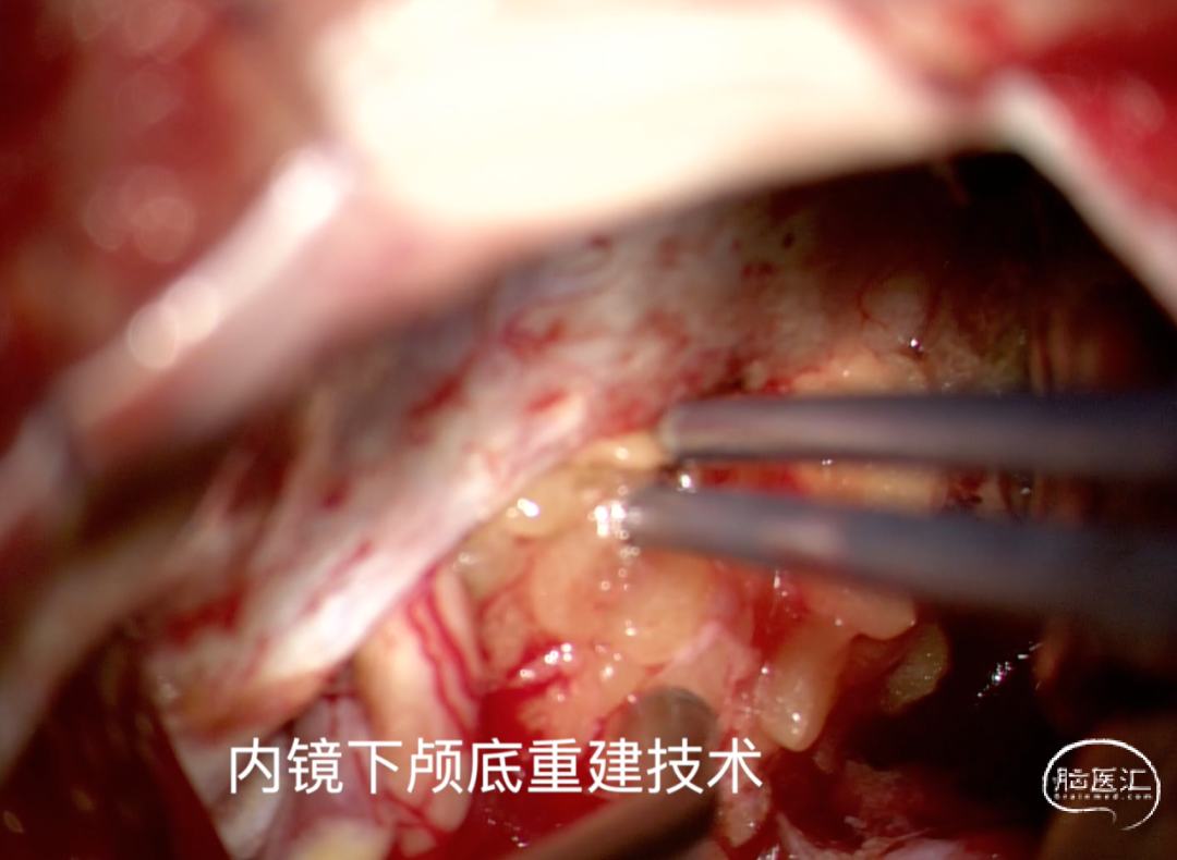 540c5aa2e7641691cf07c2626ad69e3e_640_wx_fmt=png&wxfrom=5&wx_lazy=1&wx_co=1.png