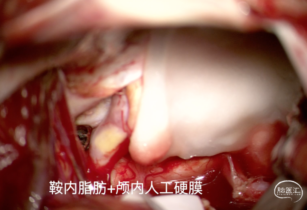 959cc2e208f621b692175b70239f736c_640_wx_fmt=png&wxfrom=5&wx_lazy=1&wx_co=1.png
