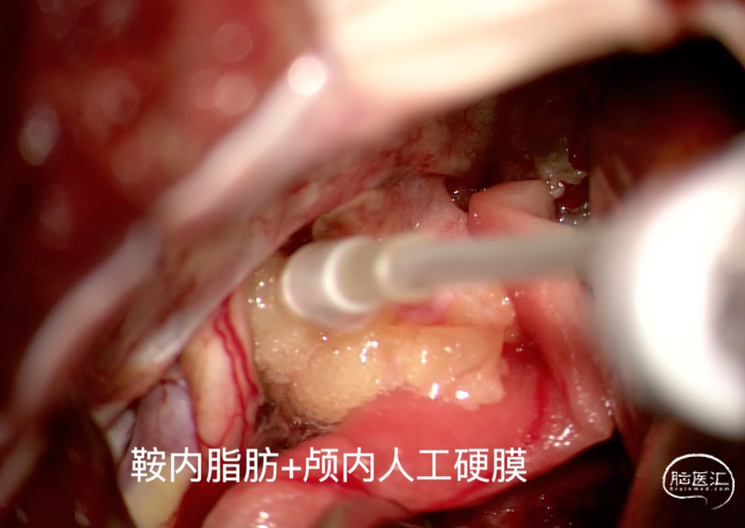 98a03e96b7690039cec05ec92fad334b_640_wx_fmt=png&wxfrom=5&wx_lazy=1&wx_co=1.png